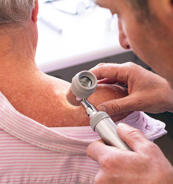 Tratamento de Câncer de Pele no Rosto  Cirurgia